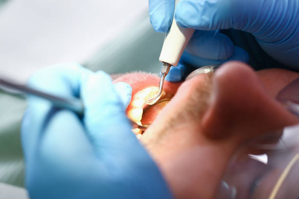 Best Emergency Dentist for Knocked-Out Tooth in Cleora, OK
